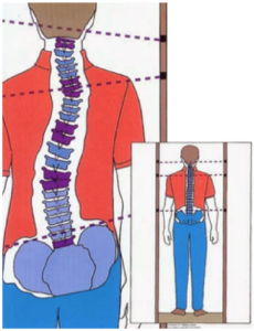 postura bacino